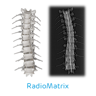 RadioMatrix 3D nyomtató alapanyag