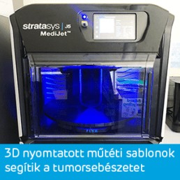 3D nyomtatott műtéti sablonok segítik a tumorsebészetet