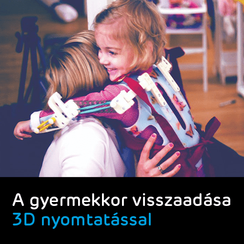 WREX 3D nyomtatott orvostechnikai eszköz