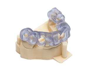 3D nyomtatott implantátum